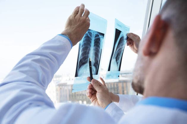 IMAGO Creative: Brustkrebsmonat Doctors discuss and looking x-ray Healthcare, medical: Group of doctors discuss and looking x-ray in a clinic or hospital, model releasedxray, medical, hospital, clinic, healthcare, health, window, radiography, examination, radiology, x-ray, diagnosis, office, surgeon, scan, doctors, image, medicine, technology, uniform, white, doctor, caucasian, practitioner, man, working, bone, cancer, team, care, anatomy, diagnostics, education, group, medics, oncologists, picture, ray, skeleton, specialist, teamwork, x, discussing, looking, people, professional, chest, injury, 