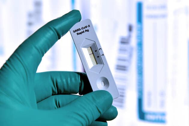 Themenbild Corona Antigen Test,Schnelltest, Coronaschnelltest.