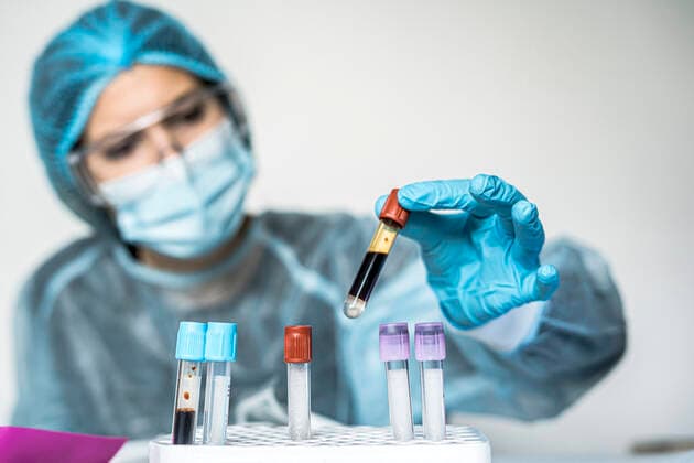 Blood test tube with label of Covid-19 also known as coronavirus or novel corona in scientist hand in laboratory. Female scientist is wearing highly protective suit, gloves, mask and glasses. Madrid, Community of Madrid, Spain CR_JFOMNK210106B-595792-01 ,model released, Symbolfoto