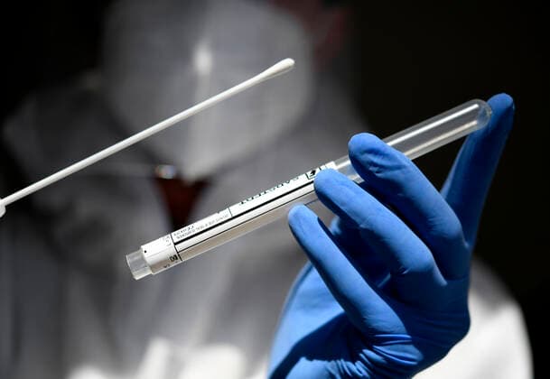 SCHNELLTEST IMPFUNG Altenheim BIONTECH PFIZER CORONA COVID 19 Impfung im JOHANNITER Senioren Stift Meerbusch am 11.02.2021 in Meerbusch