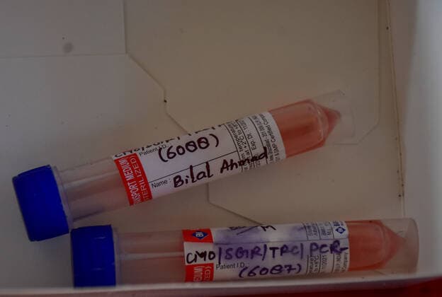 February 23, 2021, Srinagar, India: Test tubes containing live samples taken from people tested for the novel coronavirus at a coronavirus testing center in Srinagar..Jammu and Kashmir recorded 58 new COVID-19 cases which took the infection tally to 125,925, officials said. A senior doctor has warned of a second wave of COVID 19 infections, the warning has come at a time when Kashmir valley is witnessing a sharp decrease in daily cases. Srinagar India - ZUMAs197 20210223_zaa_s197_020 Copyright: xSaqibxMajeedx
