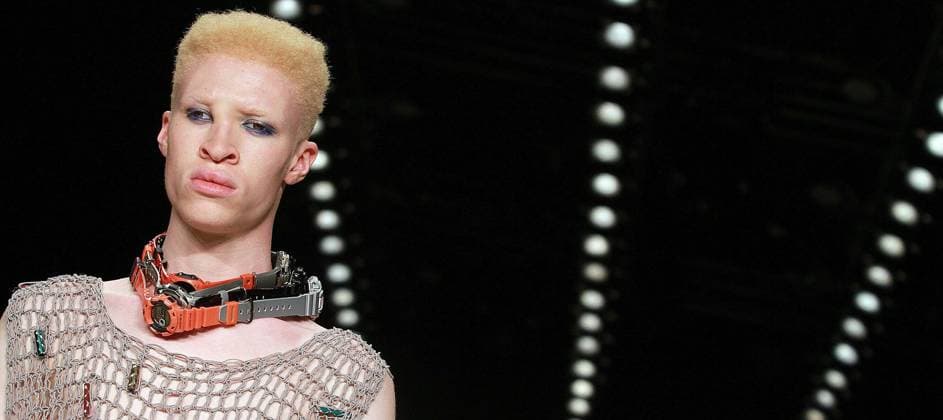 Albino Model Shaun Ross - Starsyling- Mercedes-Benz Fashionweek Berlin Summer 2010 - Bebelplatz Berlin. Copyright: xEventpressxRadkex