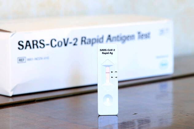 Ein negativer SARS-CoV-2 Rapid Antigen Test. Die Corona-Schnelltests gelten als erster Ausweg aus dem Lockdown. Um das Freitesten zu ermöglichen, haben Bund und Länder beschlossen, dass allen Bürgern ab Montag, dem 8. März, ein kostenloser Schnelltest pro Woche ermöglicht werden soll. (Symbolbild, Themenbild) Berlin, 05.03.2021