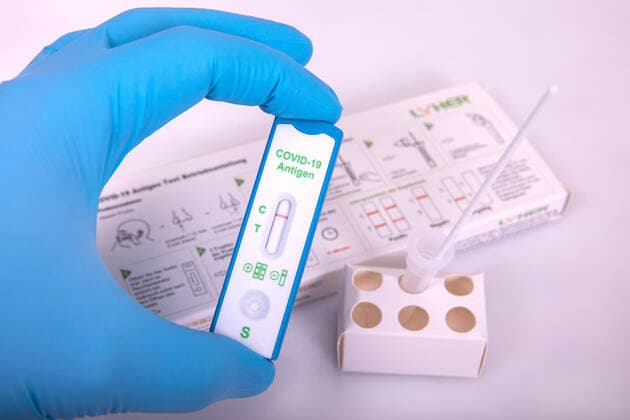 Reutlingen Themenbilder: Antigen-Testkit fuer neuartige Coronavirus, 12.03.2021, Themenbilder: Antigen-Testkit fuer neuartige Coronavirus, 12.03.2021, Copyright: xEIBNER DROFITSCHx EP_ddh
