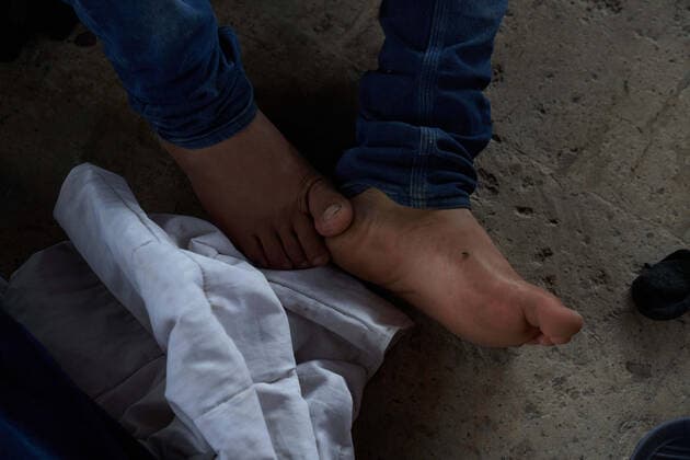 April 29, 2021, Reynosa, Mexico: A fly is seen on feet on a cement floor. Asylum seeking migrants from Central America are living on the street in Reynosa, Mexico while they wait for President Joe Biden to open the US border for them to try to cross. Reynosa Mexico - ZUMAd211 20210429_zap_d211_011 Copyright: xAllisonxDinnerx