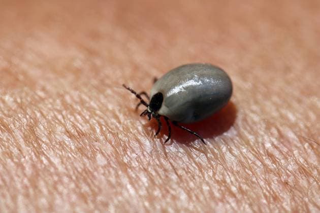 Zeckenbiss *** Tick bite 1033003264