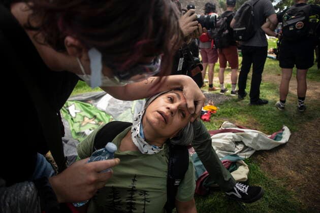 July 21, 2021, Toronto, on, Canada: An encampment supporter is treated for pepper spray as Police clear the Lamport Stadium Park encampment in Toronto on Wednesday July 21, 2021. The operation came a day after a different encampment was cleared at a downtown park. The city has cited the risk of fires and the need to make parks accessible to everyone as factors behind the clearings. Toronto Canada  - ZUMAc35_ 20210721_zaf_c35_014 Copyright: xChrisxYoungx