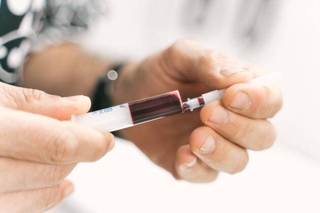 Closeup anonymous doctor with syringe and tube with blood sample of patient for diagnostics research in veterinary clinic lab, Model released IoritzLopez_VetClinicAmaita_3.jpg Copyright: xIoritzxLopezx MR