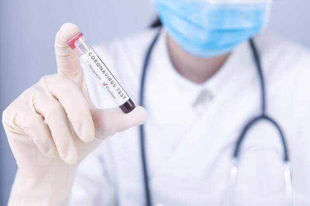 positiv,blutprobe,testergebnis,coronavirus,gut,blutproben,bluttest,test,corona,covid 19,covid-19,covid19,sars cov2,sars-cov2 *** positive,blood sample,test results,corona virus,positives,blood samples,test result sre-fov ,model released, Symbolfoto