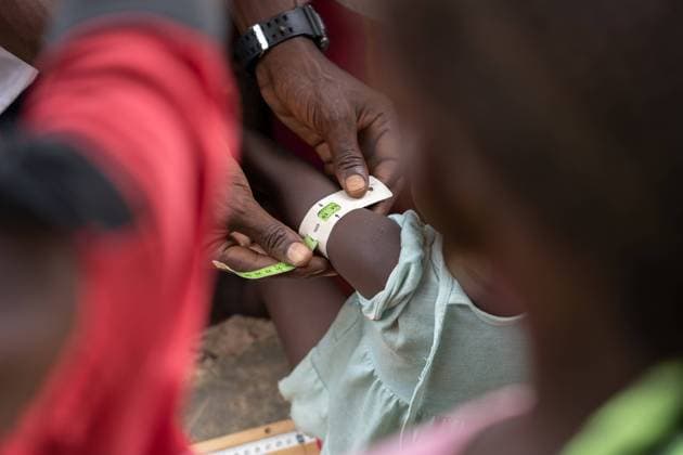 IMAGO Creative: Hunger August 20, 2021, Basse, Gambia: A health worker from the Malnutrition Education and Rehabilitation Center performs the MUAC test on a child in the rural Gambian communities as part of the national program for protection against malnutrition..During the Covid19 pandemic, the health actions carried out by hospitals and health centers have been restricted to identify and treat covid-19 related cases. Now, as restrictions ease up, actions like screening to target and treat severe malnourished cases in the villages of rural Gambia can be resumed. Basse Gambia - ZUMAs197 20210820_zaa_s197_290 Copyright: xAranxRodriguezx