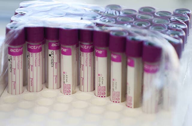 IVANOVO, RUSSIA - OCTOBER 6, 2021: Vials contain IV medicines used at City Clinical Hospital No 7 where COVID-19 patients receive treatment. Russia has reported 25,133 new confirmed coronavirus cases for the last 24 hours, with the overall number of patients reaching 7,662,560. National emergency response centre figures have been indicating daily rates over 25,000 for five days now. Vladimir Smirnov TASS  TS113438