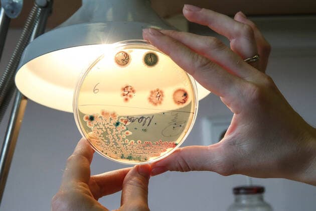 ST PETERSBURG, RUSSIA - OCTOBER 13, 2021: The Endo agar where Enterobacteriaceae bacteria grow during pre-trials of the worldâ€™s first edible COVID-19 vaccine at St Petersburgâ€™s Institute of Experimental Medicine. Based on fermented milk, the vaccine can be stored at room temperature; the key advantage of the vaccine is that it can be taken at home without visiting a medical facility of a vaccination site, which itself lowers the risk of catching COVID-19. Alexander Demianchuk TASS  TS1140CA