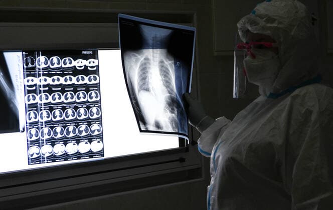 KRASNODAR, RUSSIA - OCTOBER 12, 2021: A medical worker views x-rays at a COVID-19 facility of Krasnodar s Children s Infectious Diseases Hospital. Roman Sokolov TASS  TS114116