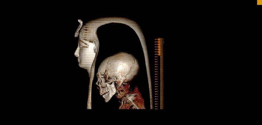 Bilder des Jahres 2021, News 12 Dezember News Bilder des Tages (211228) -- CAIRO, Dec. 28, 2021 -- This image provided by shows the head of Egyptian Pharaoh Amenhotep I and the funerary mask. Egyptian researchers have digitally unwrapped the mummy of King Amenhotep I for the first time, revealing many secrets about the pharaoh who ruled Egypt from 1525 to 1504 BC, a renowned Egyptologist said on Tuesday. Researchers used advanced x-ray technology, computed tomography (CT) scanning and advanced computer software programs to digitally remove the wrappings on the mummy of King Amenhotep I in a safe, non-invasive method without touching the mummy, Zahi Hawass, also the former Egyptian minister of state for antiquities affairs, said in a statement. ( Handout via Xinhua) EGYPT-CAIRO-PHARAOH MUMMY-DIGITAL 