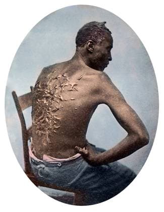 Gordon, or Whipped Peter, was a slave on a Louisiana plantation who made his escape from bondage in March of 1863 and went on to serve as a soldier in the United States Colored Troops.<br ><br > The photographs showing Gordon s flagellation scars were frequently used by abolitionists throughout the United States and internationally. In July of 1863 these images appeared in an article about Gordon published in Harper s Weekly, the most widely read journal during the Civil War.<br ><br > The pictures of Gordon s scourged back provided Northerners with visual evidence of brutal treatment of slaves and inspired many free blacks to enlist in the Union Army. Supplier:xCPAxMediaxCo.xLtd. 1060_05_cpa0028936