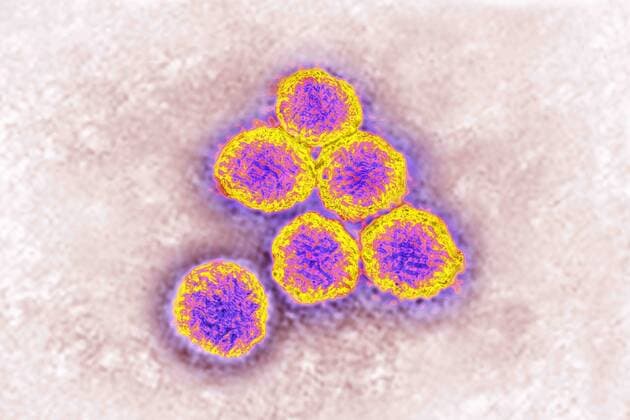 Flavivirus (family Flaviviridae), these viruses are responsible for yellow fever, dengue fever, Japanese encephalitis, Zika virus, West Nile encephalitis. They are transmitted by mosquitoes or ticks. image produced from transmission electron microscopy (viral diameter approximately 40 to 60 nm). CAVALLINIxJAMESx xBSIP 016258_038 941_04_Bsip_016258_038