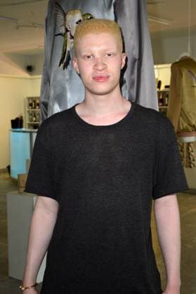 MBFW Vernissage of SHAUN ROSS and NINA ATHANASIOU - Berlin Shaun Ross (Albino-Model) at the Vernissage of SHAUN ROSS and NINA ATHANASIOU Fashion Show during the Mercedes Benz Fashion Week in Berlin 06.07.2015.