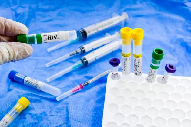 Hiv and aids infection test, doctors face and hand holding tube with blood on the blue background. Studio shoot. , 34313198.jpg, hiv, aids, test, lab, infection, virus, blood, doctor, immunology system, tube, analysis, negative, immunodefiiciency, healthcare, immune, positive, equipment, safety, immunize, blue, vaccine, clinical, needle, biological, sample, protection, bacteria, screening, hospital, patient, condom, injection, laboratory, medicine, health, disease, medical, science, technology, epidemic, research, medicament, deficiency, reactive, contamination, antibody, infected, face, woman, young