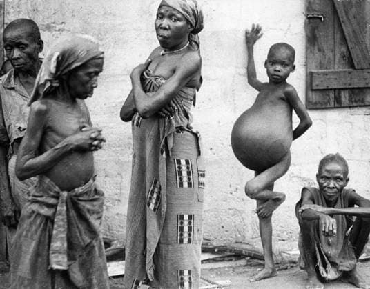 Biafra 1968-12-25 The Nigerian Civil War (also known as the Biafran War and the Nigerian-Biafran War). Famine in the Biafra region during the war. Biafra NIGERIA x53x *** Biafra 1968 12 25 The Nigerian Civil War also known as the Biafran War and the Nigerian Biafran War Famine in the Biafra region during the war Biafra NIGERIA x53x  Copyright: xSven-ErikxSjöberg DN TTx NIGERIAN CIVIL WAR