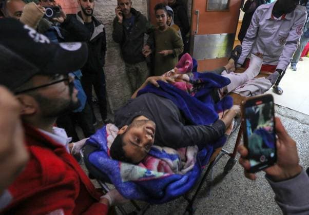 News Themen der Woche KW49 News Bilder des Tages Palestinians injured in Israeli airstrikes arrive at El-Aqsa Medical Hospital Palestinians injured in Israeli airstrikes arrive at El-Aqsa Medical Hospital on December 10, 2023 in Dair El-Balah, Gaza. amid continuing battles between Israel and the Palestinian militant group Hamas. Photo by Naaman Omar apaimages Dair El-Balah Gaza Strip Palestinian Territory 101223_Dair_El-Balah_NAA_00(13) Copyright: xapaimagesxNaamanxOmarxx xapaimagesx