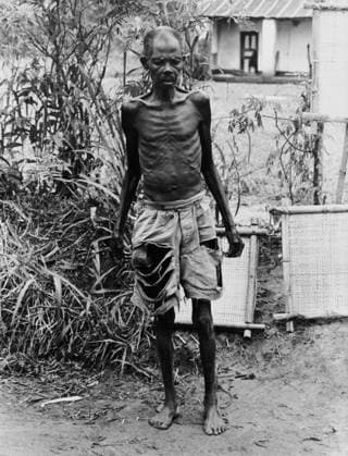 Man Suffering From Malnutrition in A Refugees Camp in Nigeria during Civil War Between Biafra and Nigeria July 3, 1968 (b w photo) 1642926 Man Suffering From Malnutrition in A Refugees Camp in Nigeria during Civil War Between Biafra and Nigeria July 3, 1968 (b w photo); (add.info.: Man suffering from malnutrition in a refugees camp in Nigeria during civil war between Biafra and Nigeria july 3, 1968). Copyright: xBridgemanxImagesx 1642926