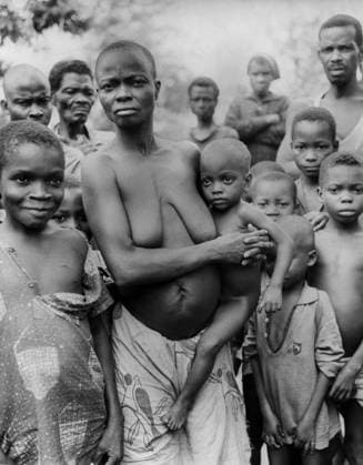 Mwanze Camp in Nigeria : The Colour of Hair of Biafran Children Has Changed Because of Malnutrition January 13, 1970 (b w photo) 1658355 Mwanze Camp in Nigeria : The Colour of Hair of Biafran Children Has Changed Because of Malnutrition January 13, 1970 (b w photo); (add.info.: Mwanze camp in Nigeria : the colour of hair of Biafran children has changed because of malnutrition january 13, 1970). Copyright: xBridgemanxImagesx 1658355