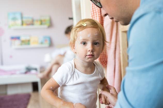 Little girl with chickenpox, unrecognizable father dressing her. Little two year old girl at home sick with chickenpox, white antiseptic cream applied by her mother to the rash. Unrecognizable father dressing her. model released Copyright: xx Kiahnikova_151