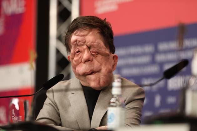 Berlin, Deutschland, 16.02.2024: Hotel Grand Hyatt: 74. Berlinale: Pressekonferenz mit dem Team (Regisseur, Schauspieler) von Film A different man : Adam Pearson *** Berlin, Germany, 16 02 2024 Hotel Grand Hyatt 74 Berlinale Press Conference with the team Director, actor of film A different man Adam Pearson Copyright: xdtsxNachrichtenagenturx dts_30789