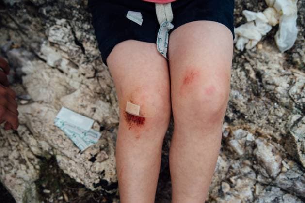 Creative Highlights Symbolbilder Close up of child s skinned knee with bandages and wrappers. Keystone, South Dakota, United States CR_KIFR240402-1377304-01 ,model released, Symbolfoto