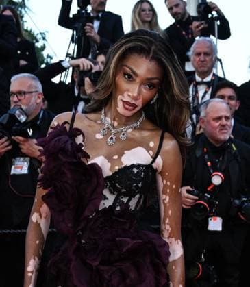 Cannes, 77th Cannes Film Festival 2024 Red Carpet of the film Le Compte de Monte-Cristo Cannes, 77th Cannes Film Festival 2024 Red Carpet of the film Le Compte de Monte-Cristo In the photo: Winnie Harlow Cannes France  Copyright: xIPA ABACAx