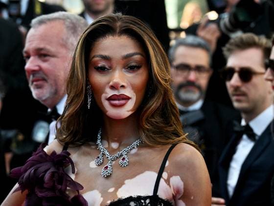 Cannes, 77th Cannes Film Festival 2024, Ninth Night. Red carpet of the film Le Comte de Monte-Cristo In the photo: Winnie Harlow  Copyright: xManuelexMangiarottix xipa-agencyx xPoolxPhotoxEventsx03x IPA_Agency_IPA46409212
