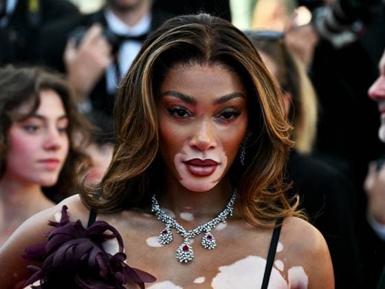 Cannes, France: Cannes, 77th Cannes Film Festival 2024, Ninth Night. Red carpet of the film Ã¢â‚¬oeLe Comte de Monte-CristoÃ¢â‚¬Â In the photo: Winnie Harlow Cannes France  - ZUMAp169 20240522_zea_p169_794 Copyright: xManuelexMangiarottix