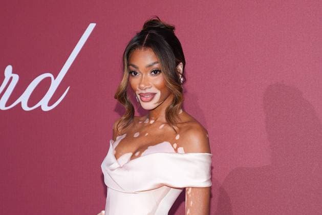 Winnie Harlow bei der Amfar Gala am 23.05.2024 im Rahmen vom 77. Film Festival in Cannes Cannes Film Festival 2024 - Amfar Gala