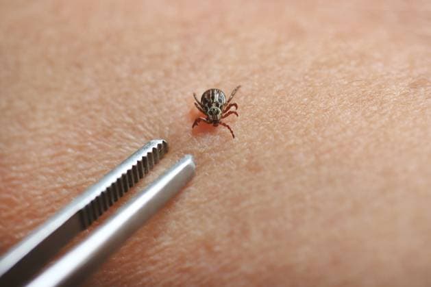 Zecke, Gemeiner Holzbock (Ixodes ricinus), Zecke wird mit einer Pinzette entfernt European castor bean tick, European sheep tick (Ixodes ricinus), Tick is removed with tweezers BLWS714619 *** Tick, Common Holzbock Ixodes Ricinus , Tick will with a Tweezers removed European Castor Bean tick, European Sheep Tick Ixodes Ricinus , Tick IS removed With tweezers BLWS714619 Copyright: xblickwinkel R.xRebmannx
