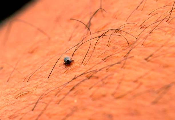 11.09.2024, Heimische Zecke sucht sich auf der menschlichen Haut eine Stelle zum Blut saugen. Gemeiner Holzbock (Ixodes ricinus) 11.09.2024, Zecke 11.09.2024, Zecke *** 11 09 2024, Native tick searches for a place on human skin to suck blood Common wood tick Ixodes ricinus 11 09 2024, Tick 11 09 2024, Tick