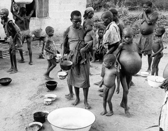 BIAFRA 1968-12-26. Hungersnöd i Biafra i samband med Biafrakriget. Undernärda barn och vuxna. Biafra Nigeria x53x *** BIAFRA 1968 12 26 Famine in Biafra during the Biafran War Malnourished children and adults Biafra Nigeria x53x  Copyright: xSven-ErikxSjöberg DN TTx HUNGERSNÖD BIAFRA