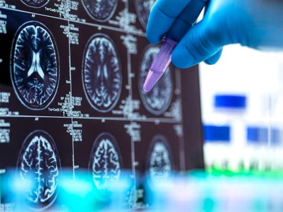 Mature scientist examining medical sample near MRI scan on screen model released, Symbolfoto property released, ABRF01271