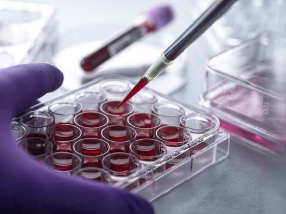 Biomedice various Cell Research, Scientist pipetting blood for cell research during a clinical trail in the lab High Wycombe, Bucks UK brnd00306 Copyright: xConnectxImagesx ,model released ,property released