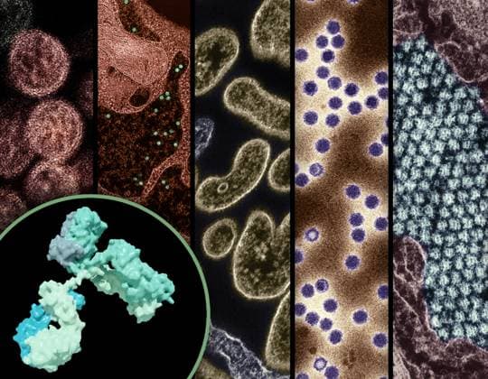 A 3D rendering of an antibody (foreground left), and examples of high-priority &quotprototype&quot pathogens that have the potential to threaten human health are the focus of pandemic preparedness research efforts (left to right): hantavirus, yellow fever virus, Nipah virus, picornavirus, and Chikungunya. As of September 2024, The National Institutes of Health (NIH) has established a pandemic preparedness research network known as ReVAMPP to conduct research on high-priority pathogens with the goal of developing effective vaccines and monoclonal antibodies. Credit: NIAID See related September 13, 2024 NIAID news release, &quotNIH Awards Establish Pandemic Preparedness Research Network,&quot at. Pandemic Preparedness: Examples of High-Priori 016931_045