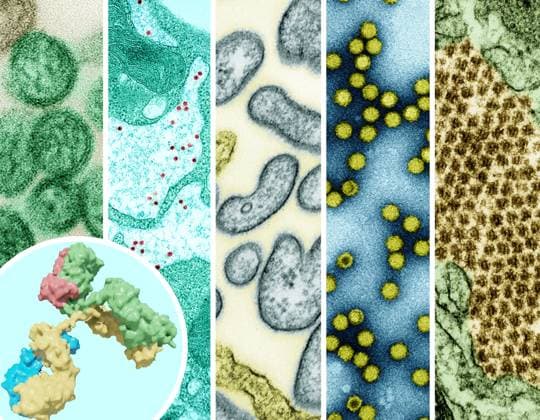 A 3D rendering of an antibody (foreground left), and examples of high-priority &quotprototype&quot pathogens that have the potential to threaten human health are the focus of pandemic preparedness research efforts (left to right): hantavirus, yellow fever virus, Nipah virus, picornavirus, and Chikungunya. As of September 2024, The National Institutes of Health (NIH) has established a pandemic preparedness research network known as ReVAMPP to conduct research on high-priority pathogens with the goal of developing effective vaccines and monoclonal antibodies. Credit: NIAID See related September 13, 2024 NIAID news release, &quotNIH Awards Establish Pandemic Preparedness Research Network,&quot at. Pandemic Preparedness: Examples of High-Priori 016931_046