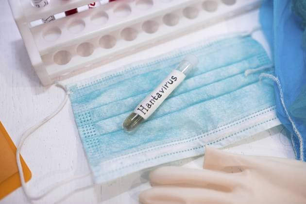 Reagenzglas mit der Aufschrift Hantavirus auf einer Maske, mit Handschuhen in einer Laborumgebung Test tube labeled Hantavirus on a mask, with gloves in a lab setting Copyright: imageBROKER MikalaixSayevich ibxwsp12339833.jpg