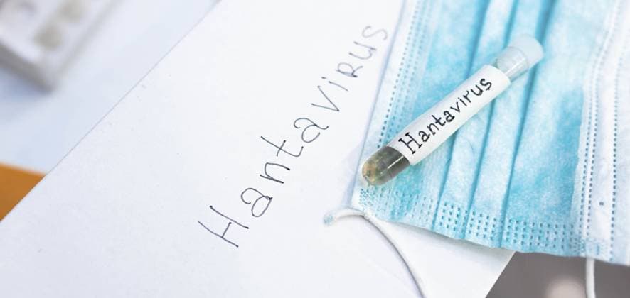 Ein Reagenzglas mit der Aufschrift Hantavirus auf Papier neben einer Gesichtsmaske A test tube labeled Hantavirus on paper next to a face mask Copyright: imageBROKER MikalaixSayevich ibxwsp12339838.jpg