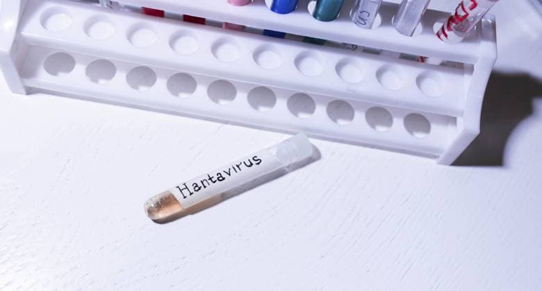 Reagenzglas mit der Aufschrift Hantavirus in der Nähe eines Regals in einem Labor Test tube labeled Hantavirus placed near a rack in a lab setting Copyright: imageBROKER MikalaixSayevich ibxwsp12339831.jpg