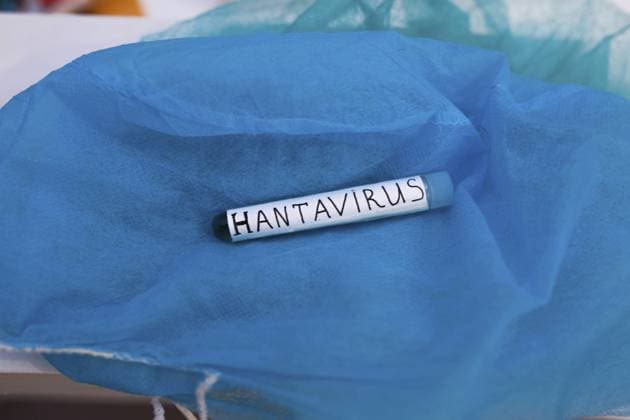 Ein Reagenzglas mit der Aufschrift Hantavirus auf einem blauen Stoffhintergrund A test tube labeled Hantavirus on a blue cloth background Copyright: imageBROKER MikalaixSayevich ibxwsp12339834.jpg