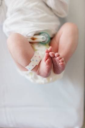 Close-up of newborn baby feet with hospital band and diaper United States, Pennsylvania, Pittsburgh R_QIWH250730A-1795122-01 ,model released, Symbolfoto