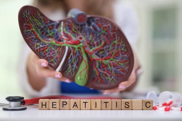 Comprehensive Model for Understanding Hepatitis C and Promoting Liver Health Awareness A comprehensive and detailed liver model that illustrates hepatitis C, crucial for enhancing healthcare education, model released, , 64329510.jpg RECORD DATE NOT STATED