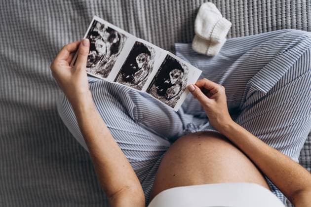 Pregnant woman sitting at home viewing ultrasound image in bedroom model released, Symbolfoto property released, KANF00090