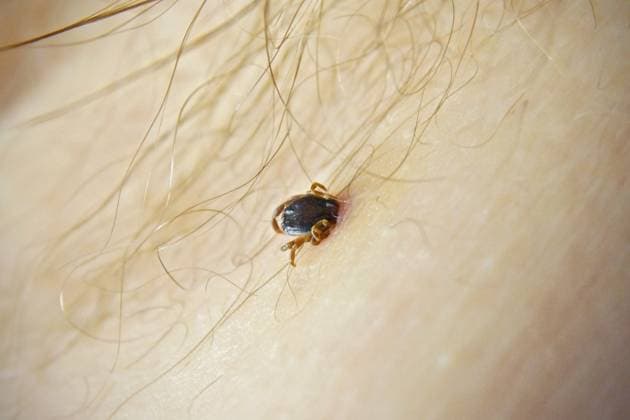 Hyalomma Zecke, Nahaufnahme, Zeckenbiss in der Achselhöhle, Kreta, Griechenland *** Hyalomma tick, close-up, tick bite in the armpit, Crete, Greece