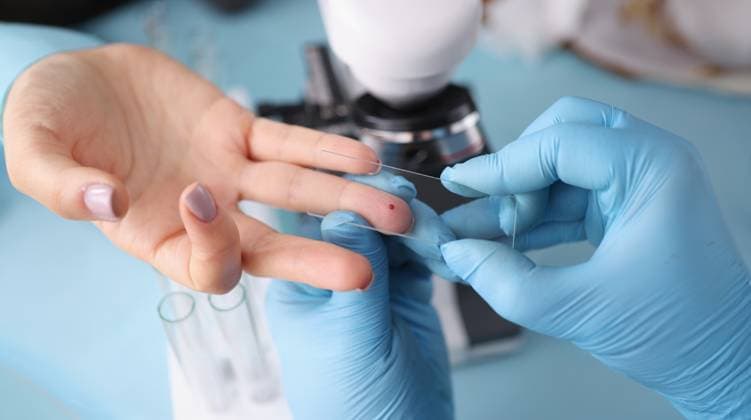 Taking a blood test for examination in patients Taking a blood test for examination in patients. Laboratory blood test concept, 60674250.jpg RECORD DATE NOT STATED