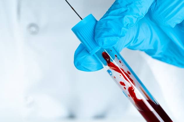 Doctor in blue gloves keep in hands test tube with a blood and syringe Doctor in blue gloves keep in hands test tube with a blood and syringe, 61969700.jpg RECORD DATE NOT STATED